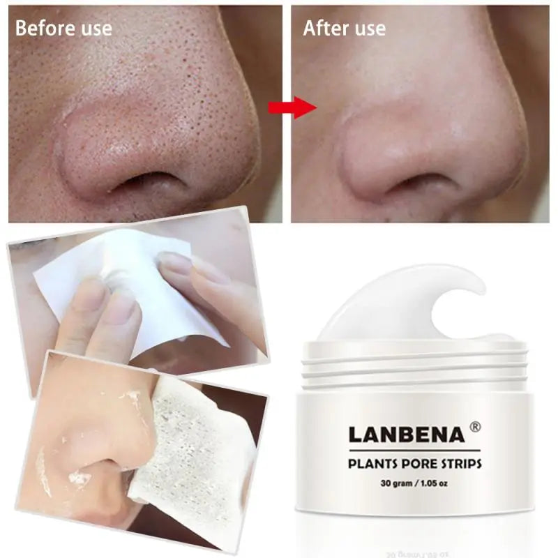 Nose Pore Strips Blackhead Cream